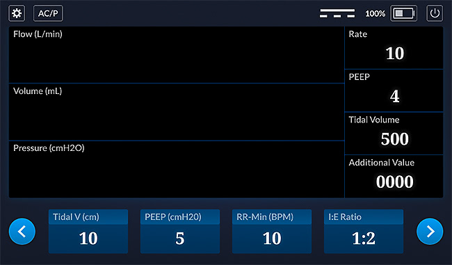 RespiraWorks UI